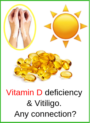 Vitamin D Vitiligo Sunlight