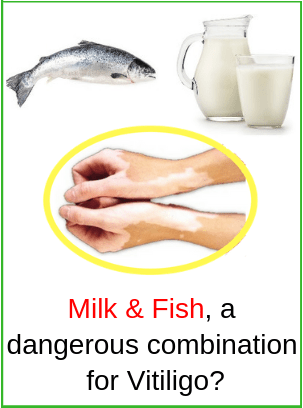 Milk Fish Dairy Vitiligo Leucoderma