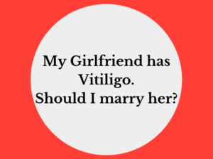 Vitiligo Girlfriend Marriage Dating